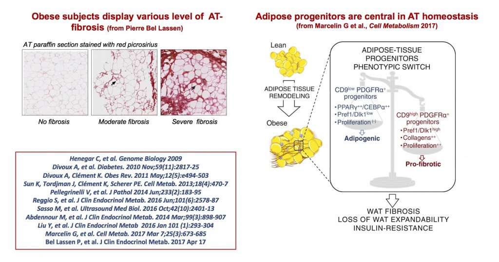 Topic 3: Adipose tissue Remodeling results