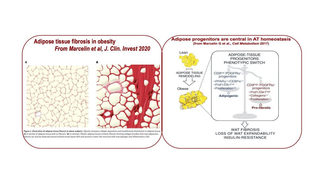 Topic 3: Adipose tissue Remodeling results